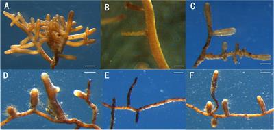 Black Truffles Affect Quercus aliena Physiology and Root-Associated nirK- and nirS-Type Denitrifying Bacterial Communities in the Initial Stage of Inoculation